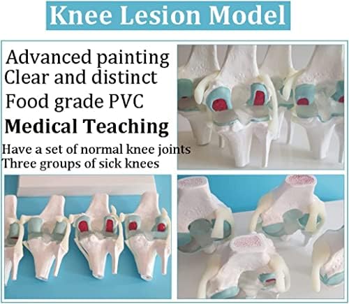 Luvadu zcx модел на колено модел на настава анатомија колено остеоартритис патологија човечко тело модел на анатомија студија настава