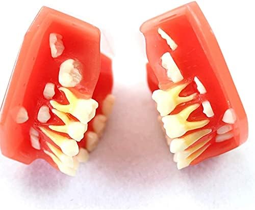 Наставен модел, модел на заби за образование - Деца Деца листопадни заби модел на заби на заби - модел на обука на орални заби за орални човечки заби - за ентузијасти ?
