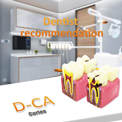 Модел на заби на заби Д-ЦА, транспарентен стоматолошки имплантација на заби модел Стоматолошка стандардна болест Отстранлив модел