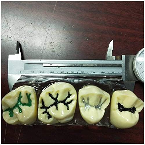 Модел на настава PSVOD, модел на заби на заби на анатомија - Модел за затворање на стоматолошки сулкус - Анти -црвенило на забите спречуваат