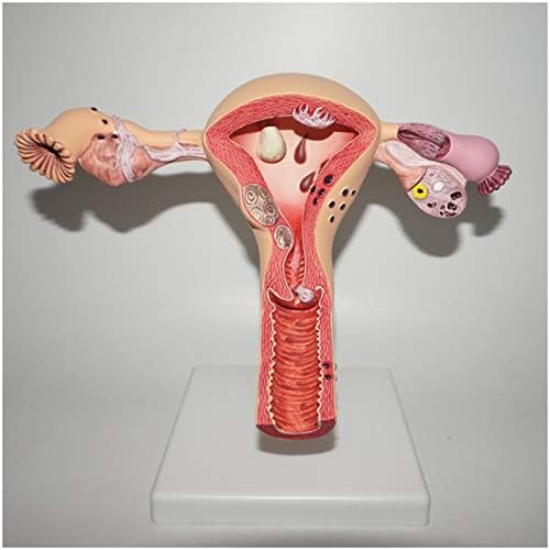 KH66ZKY Човечки патолошки матка Модел на јајници - Модел на матка - Организација на жени - Medicalенски репродуктивни органи за медицинска лезија за учење алатка за учење