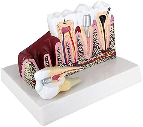 Модел на пресек на заби на лемита - модел на анатомија модел на заби за заби одводно образование за образование Стоматолошки