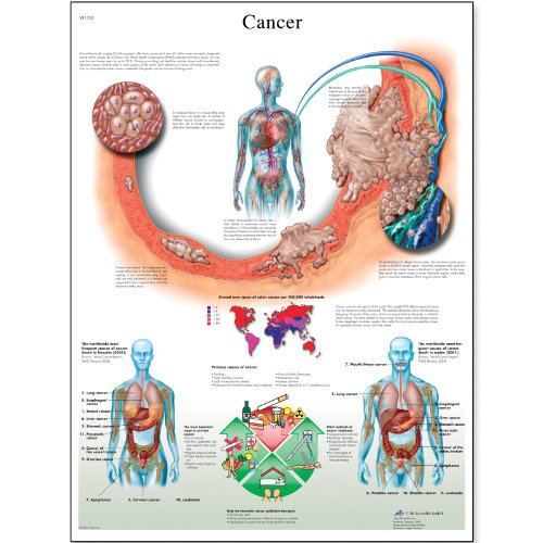3B Научен VR1753UU сјајно хартија Рак Анатомска табела, големина на постери 20 ширина x 26 Висина